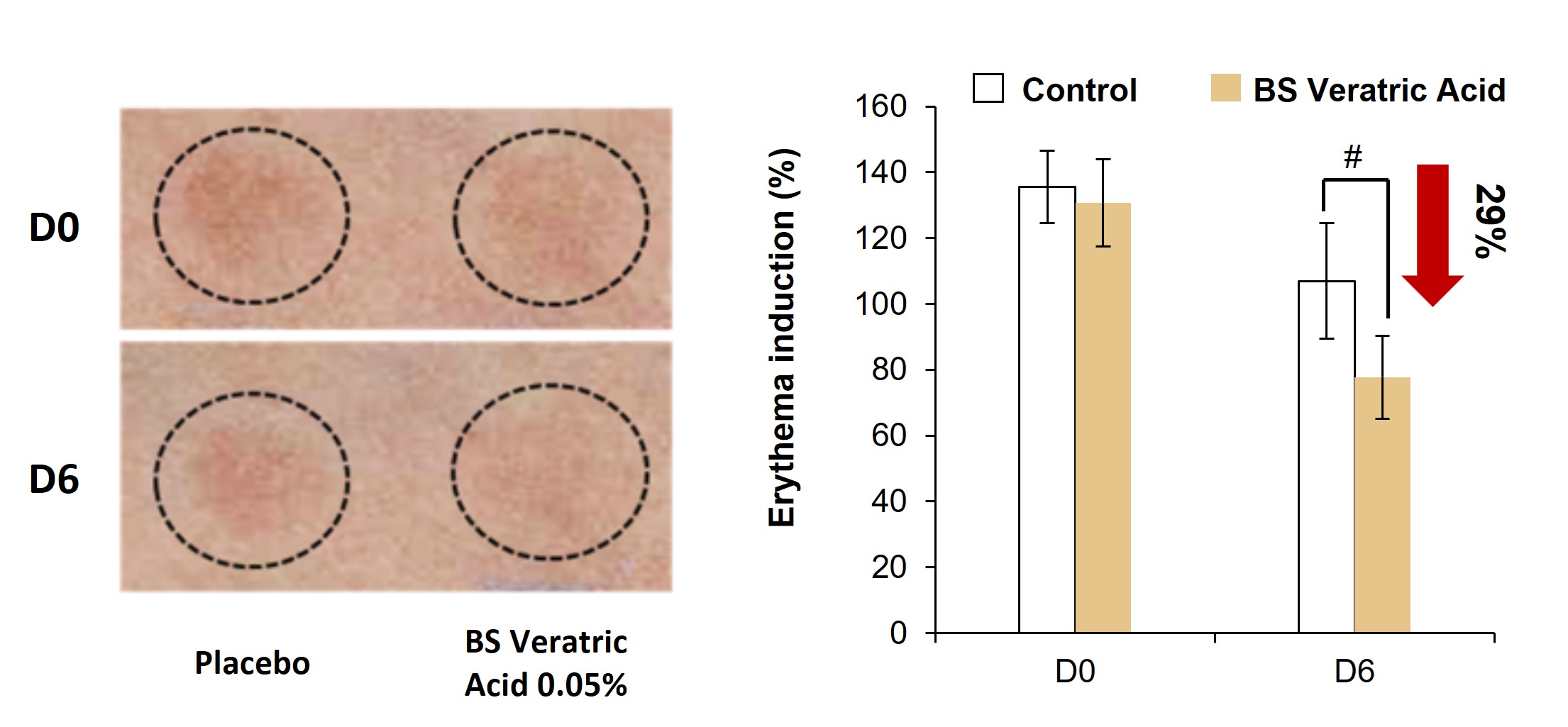 [In vivo 자외선 보호 효능]
