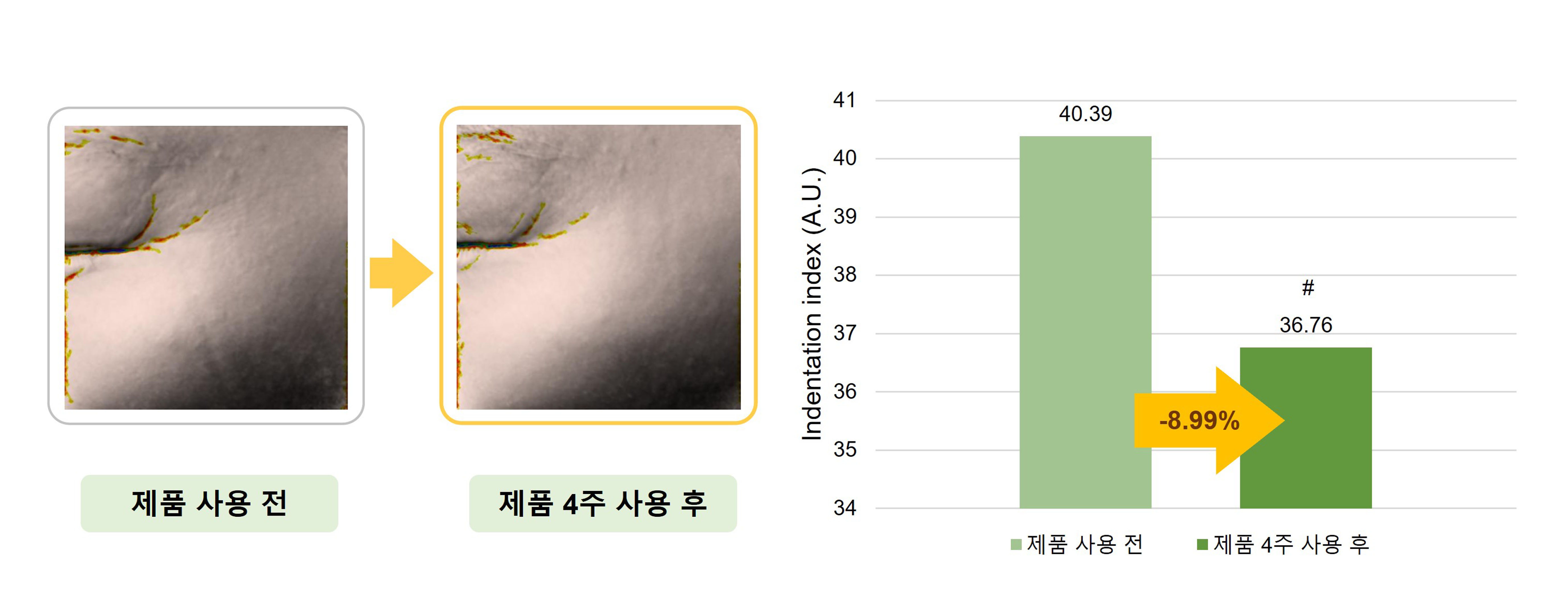 RhuStem의 주름개선 효과