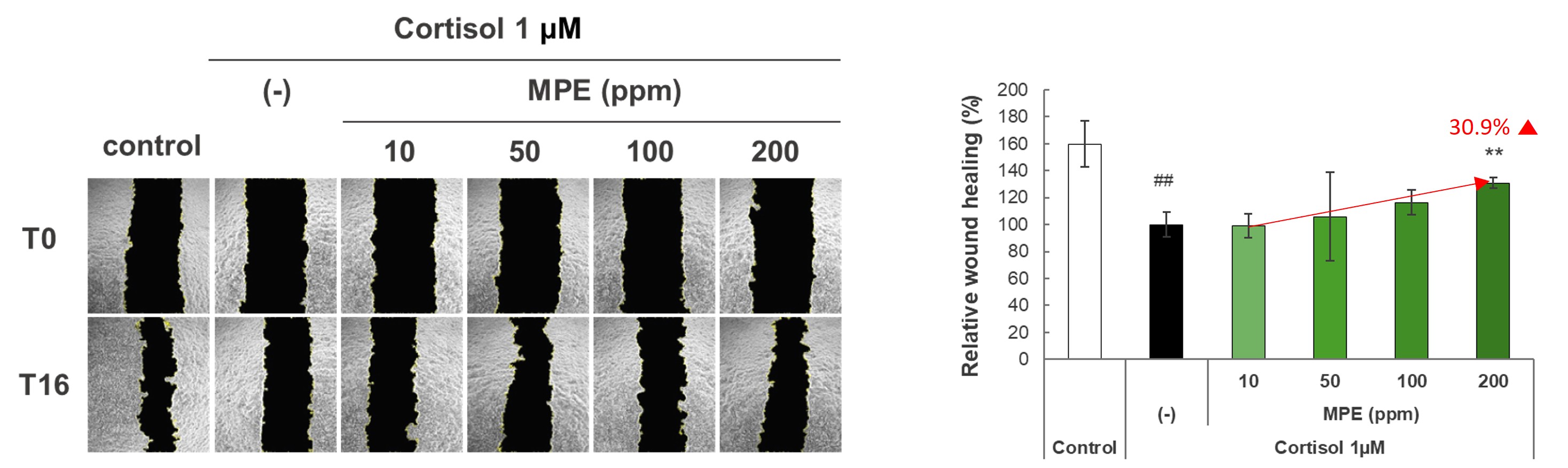 Cortisol 유도 상처 회복 지연 개선